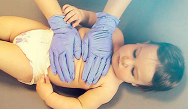terapias masaje infantil